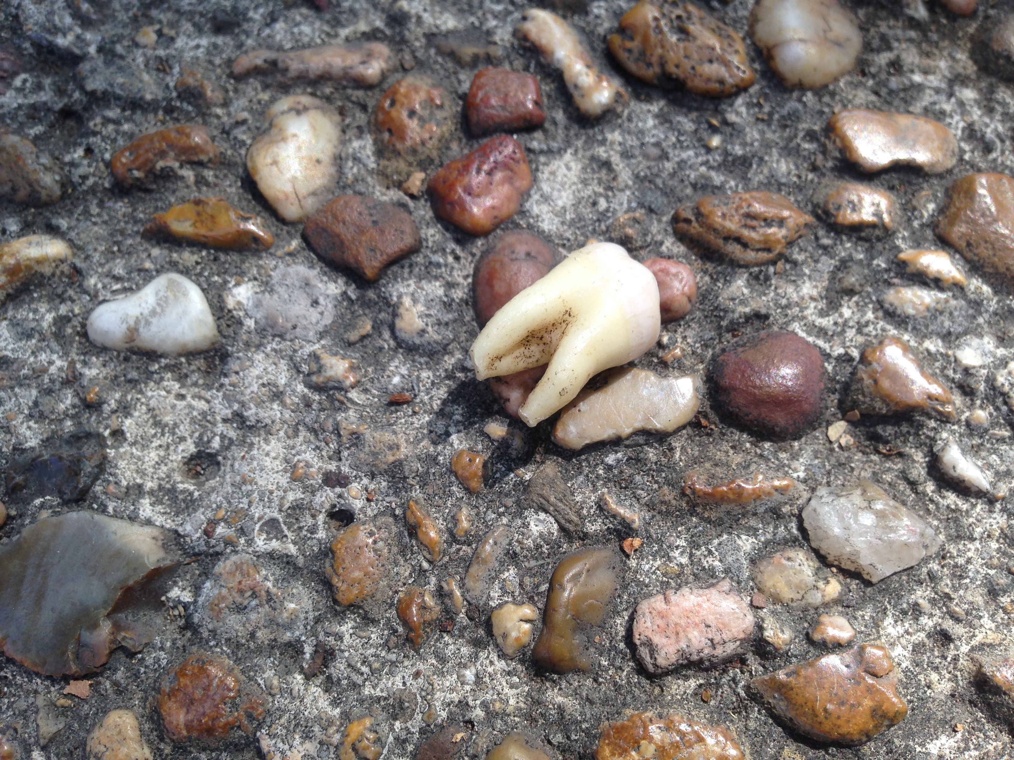 Tooth found on the Quad